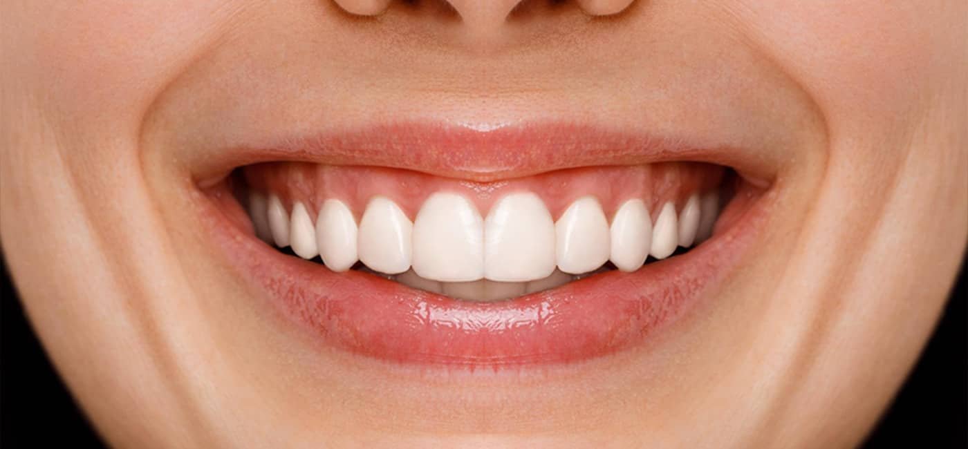 Dental treatment after view