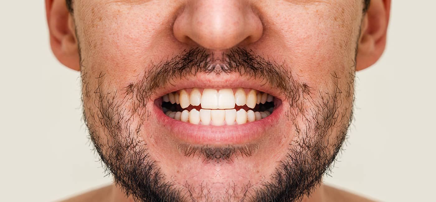 Dental treatment after view