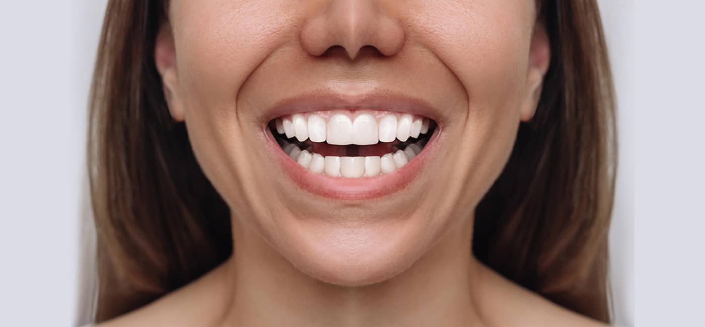 Dental treatment after view