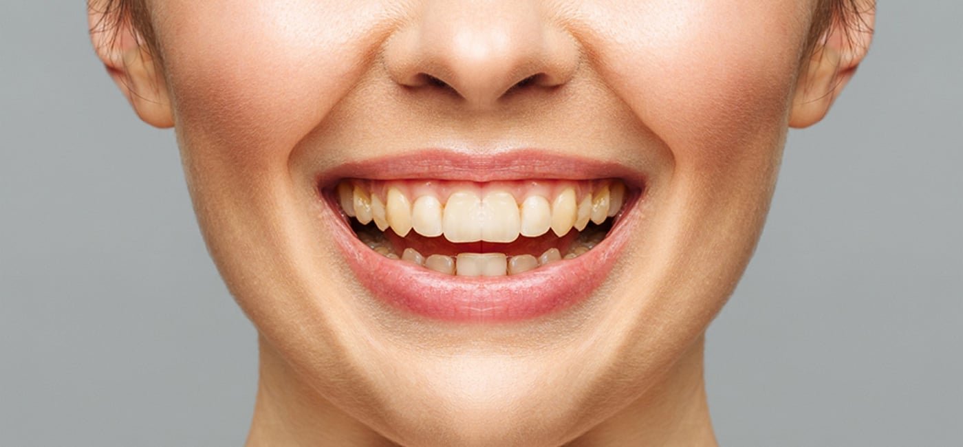 Dental treatment before view