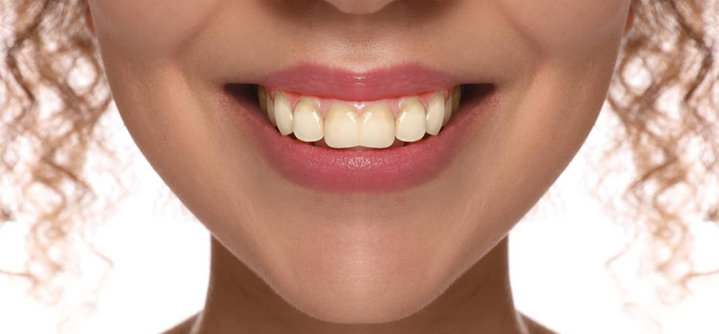 Dental treatment before view