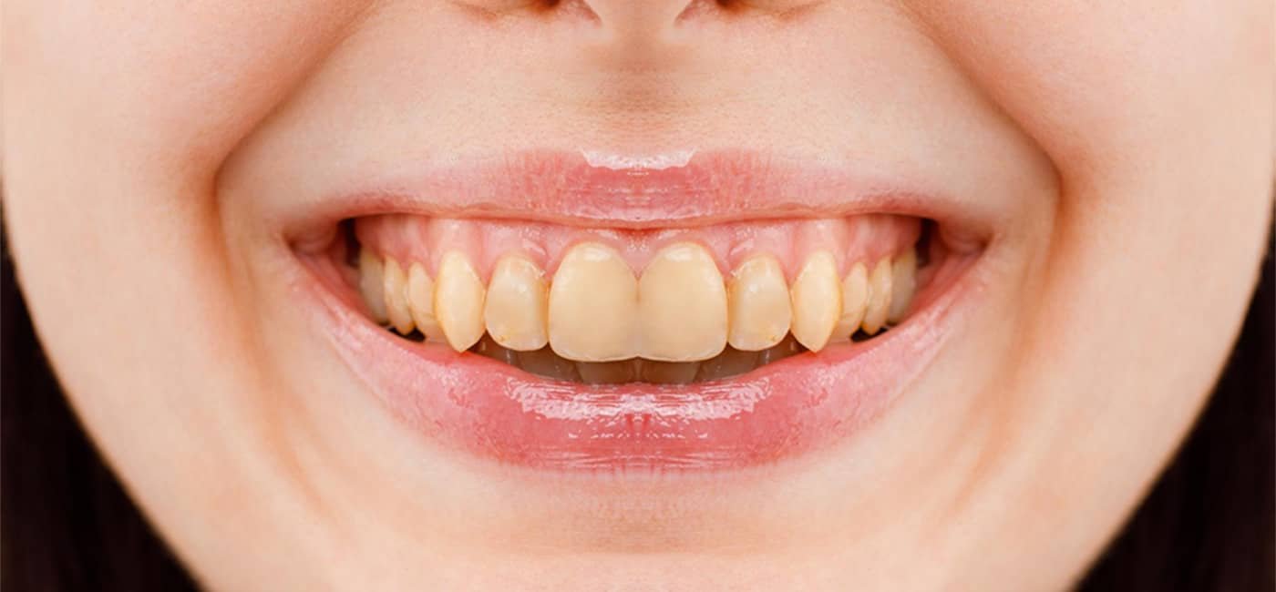 Dental treatment before view