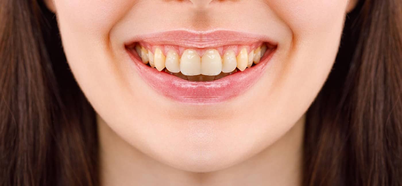Dental treatment before view