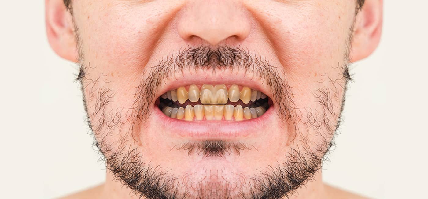 Dental treatment before view