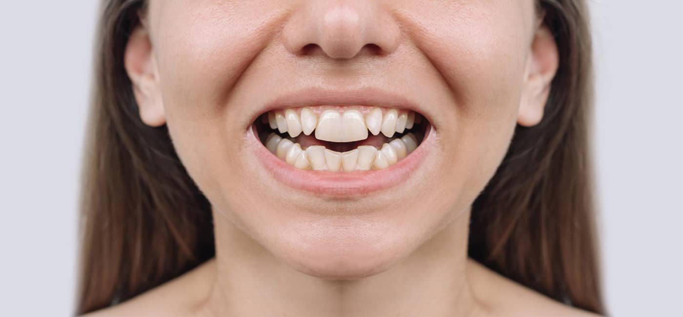 Dental treatment before view